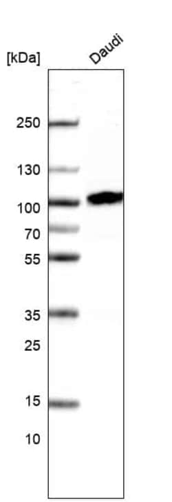 CD19 Antibody (CL15454) [Unconjugated], Novus Biologicals:Antibodies:Primary