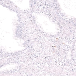 CD19 Antibody (CL15454) [Unconjugated], Novus Biologicals:Antibodies:Primary