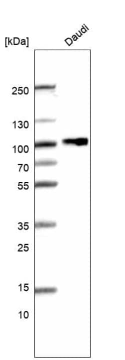CD19 Antibody (CL15459) [Unconjugated], Novus Biologicals:Antikörper:Primärantikörper