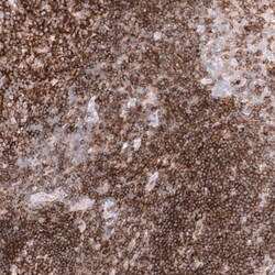 CD19 Antibody (CL15459) [Unconjugated], Novus Biologicals:Antikörper:Primärantikörper