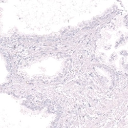 CD19 Antibody (CL15459) [Unconjugated], Novus Biologicals:Antikörper:Primärantikörper