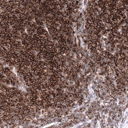 CD19 Antibody (CL15459) [Unconjugated], Novus Biologicals:Antikörper:Primärantikörper