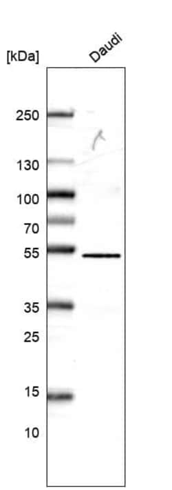 CD27/TNFRSF7 Antibody (CL15464) [Unconjugated], Novus Biologicals:Antibodies:Primary