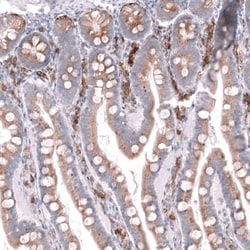 CD27/TNFRSF7 Antibody (CL15464) [Unconjugated], Novus Biologicals:Antibodies:Primary