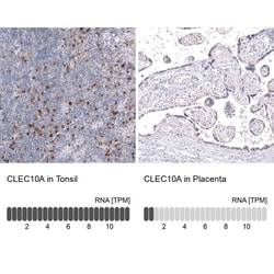 CLEC10A/CD301 Antibody (CL15513) [Unconjugated], Novus Biologicals:Antibodies:Primary
