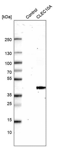 CLEC10A/CD301 Antibody (CL15513) [Unconjugated], Novus Biologicals:Antibodies:Primary