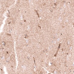 CLEC10A/CD301 Antibody (CL15513) [Unconjugated], Novus Biologicals:Antibodies:Primary