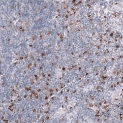 CLEC10A/CD301 Antibody (CL15513) [Unconjugated], Novus Biologicals:Antibodies:Primary