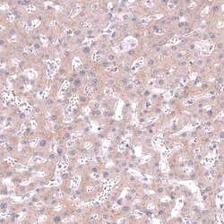 CLEC10A/CD301 Antibody (CL15523) [Unconjugated], Novus Biologicals 100 &mu;L | Buy Online | Novus Biologicals | Fisher Scientific