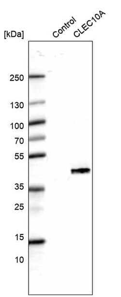 CLEC10A/CD301 Antibody (CL15523) [Unconjugated], Novus Biologicals 100 &mu;L | Buy Online | Novus Biologicals | Fisher Scientific