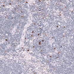 CLEC10A/CD301 Antibody (CL15523) [Unconjugated], Novus Biologicals 100 &mu;L | Buy Online | Novus Biologicals | Fisher Scientific