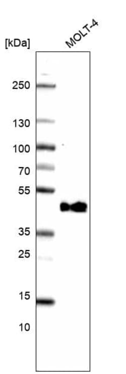 CD38 Antibody (CL15572) [Unconjugated], Novus Biologicals 25 &mu;L; Unconjugated:Antibodies,