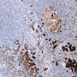 CD38 Antibody (CL15572) [Unconjugated], Novus Biologicals 25 &mu;L; Unconjugated:Antibodies,