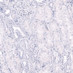 CD38 Antibody (CL15572) [Unconjugated], Novus Biologicals 25 &mu;L; Unconjugated:Antibodies,