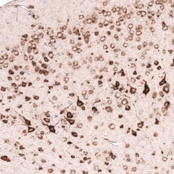 Pleiotrophin/PTN Antibody (CL15628) [Unconjugated], Novus Biologicals:Antibodies:Primary