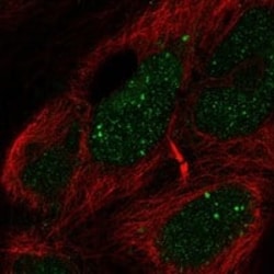 EBF-2 Antibody [Unconjugated], Novus Biologicals 25 &mu;L; Unconjugated:Antikörper