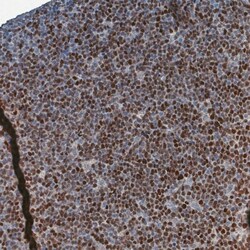 SOX11 Antibody (CL0142) - Azide and BSA Free, Novus Biologicals 100 ul;