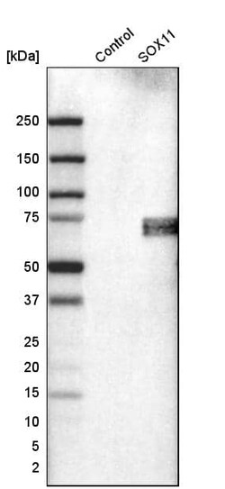 SOX11 Antibody (CL0142) - Azide and BSA Free, Novus Biologicals 100 ul;