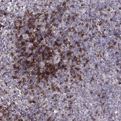 CD8 Antibody (CL1529) - Azide and BSA Free, Novus Biologicals 100 ul; Unconjugated:Antibodies,