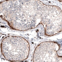 Laminin Antibody (CL2968) - Azide and BSA Free, Novus Biologicals 100 ul;