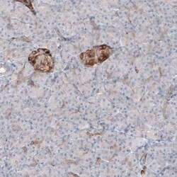 MAP2 Antibody (CL5420) - Azide and BSA Free, Novus Biologicals 100 ul;