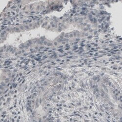 UCH-L1/PGP9.5 Antibody (CL3210) - Azide and BSA Free, Novus Biologicals