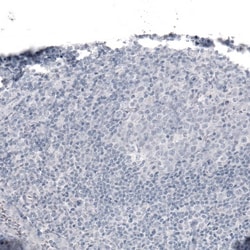 Laminin alpha 2 Antibody (CL3450) - Azide and BSA Free, Novus Biologicals