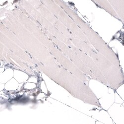 ADAM10 Antibody (CL13809) - Azide and BSA Free, Novus Biologicals 100 ul;