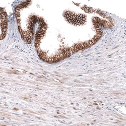 ADAM10 Antibody (CL13809) - Azide and BSA Free, Novus Biologicals 100 ul;