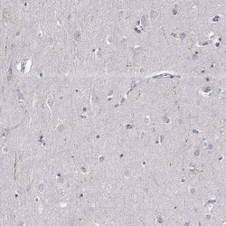 SLC6A3/DAT1 Antibody (CL3123) - Azide and BSA Free, Novus Biologicals 100