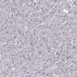 SLC6A3/DAT1 Antibody (CL3123) - Azide and BSA Free, Novus Biologicals 100