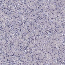 SLC6A3/DAT1 Antibody (CL3123) - Azide and BSA Free, Novus Biologicals 100
