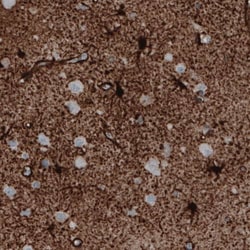Glutamine Synthetase Antibody (CL2999) - Azide and BSA Free, R D Systems 100 &mu;L | Buy Online | Novus Biologicals | Fisher Scientific