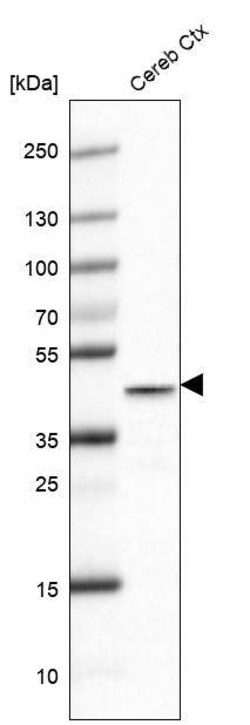 Glutamine Synthetase Antibody (CL2999) - Azide and BSA Free, R D Systems 100 &mu;L | Buy Online | Novus Biologicals | Fisher Scientific