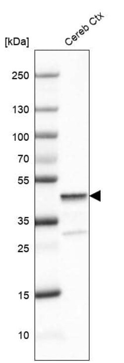 Glutamine Synthetase Antibody (CL2999) - Azide and BSA Free, R D Systems 100 &mu;L | Buy Online | Novus Biologicals | Fisher Scientific