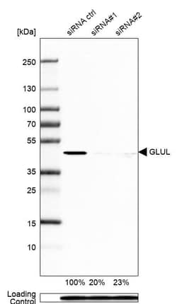 Glutamine Synthetase Antibody (CL2999) - Azide and BSA Free, R D Systems 100 &mu;L | Buy Online | Novus Biologicals | Fisher Scientific