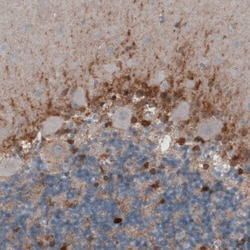 Glutamine Synthetase Antibody (CL3004) - Azide and BSA Free, Novus Biologicals