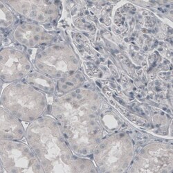 Glutamine Synthetase Antibody (CL3004) - Azide and BSA Free, Novus Biologicals