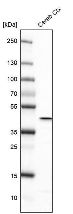 Glutamine Synthetase Antibody (CL3004) - Azide and BSA Free, Novus Biologicals