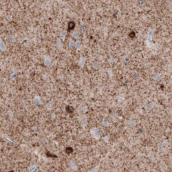 GAD1/GAD67 Antibody (CL2911) - Azide and BSA Free, Novus Biologicals 100