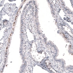 FoxP2 Antibody (CL5310) - Azide and BSA Free, Novus Biologicals 100 ul;