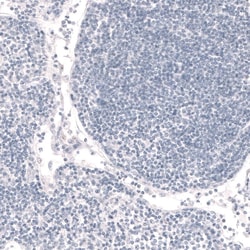 FoxP2 Antibody (CL5310) - Azide and BSA Free, Novus Biologicals 100 ul;