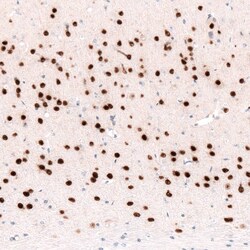 FoxP2 Antibody (CL5310) - Azide and BSA Free, Novus Biologicals 100 ul;