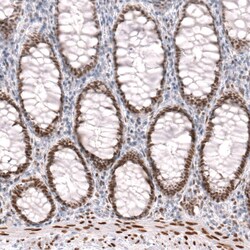 FoxP2 Antibody (CL5310) - Azide and BSA Free, Novus Biologicals 100 ul;