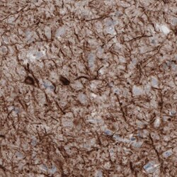 NF-M Antibody (CL2688) - Azide and BSA Free, Novus Biologicals 100 ul;
