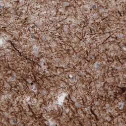 NF-M Antibody (CL2705) - Azide and BSA Free, Novus Biologicals 100 ul;