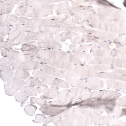 ADAM10 Antibody (CL13808) - Azide and BSA Free, Novus Biologicals 100 ul;