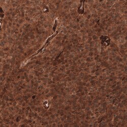 ADAM10 Antibody (CL13814) - Azide and BSA Free, Novus Biologicals 100 ul;