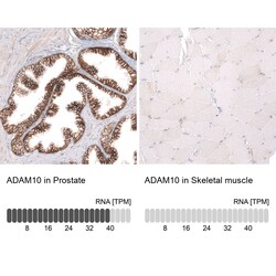 ADAM10 Antibody (CL13814) - Azide and BSA Free, Novus Biologicals 100 ul;