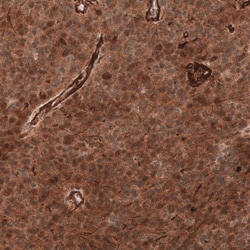 ADAM10 Antibody (CL13815) - Azide and BSA Free, Novus Biologicals 100 ul;